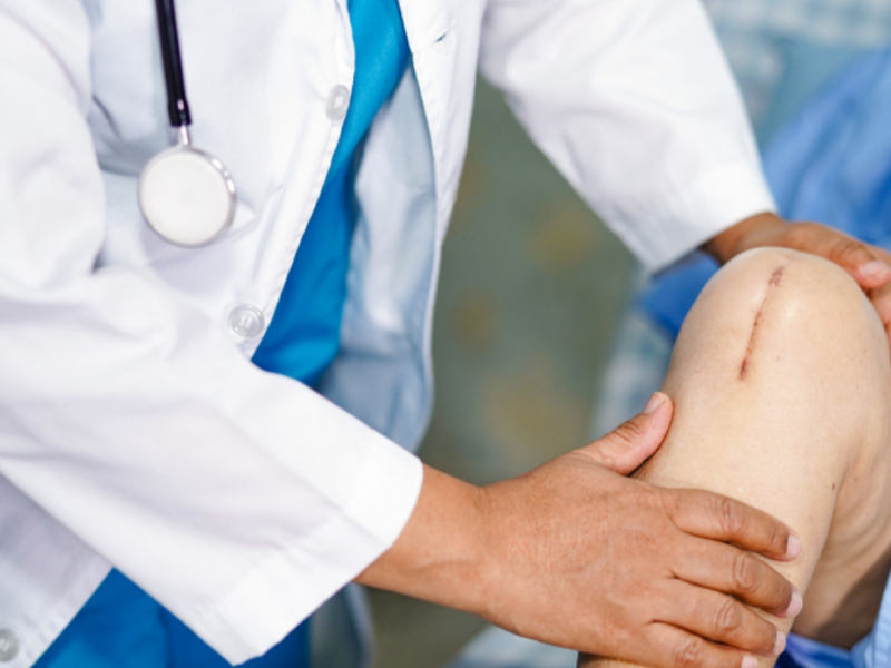 best Knee replacement hospital in kanpur